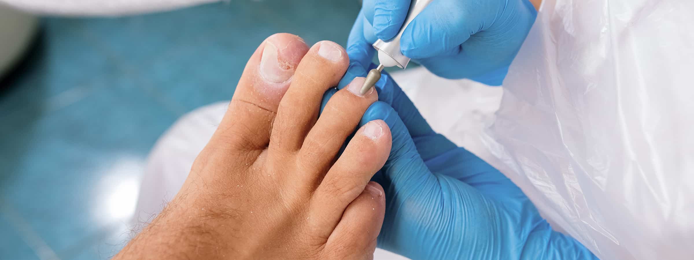 Послуги подолога у Львові