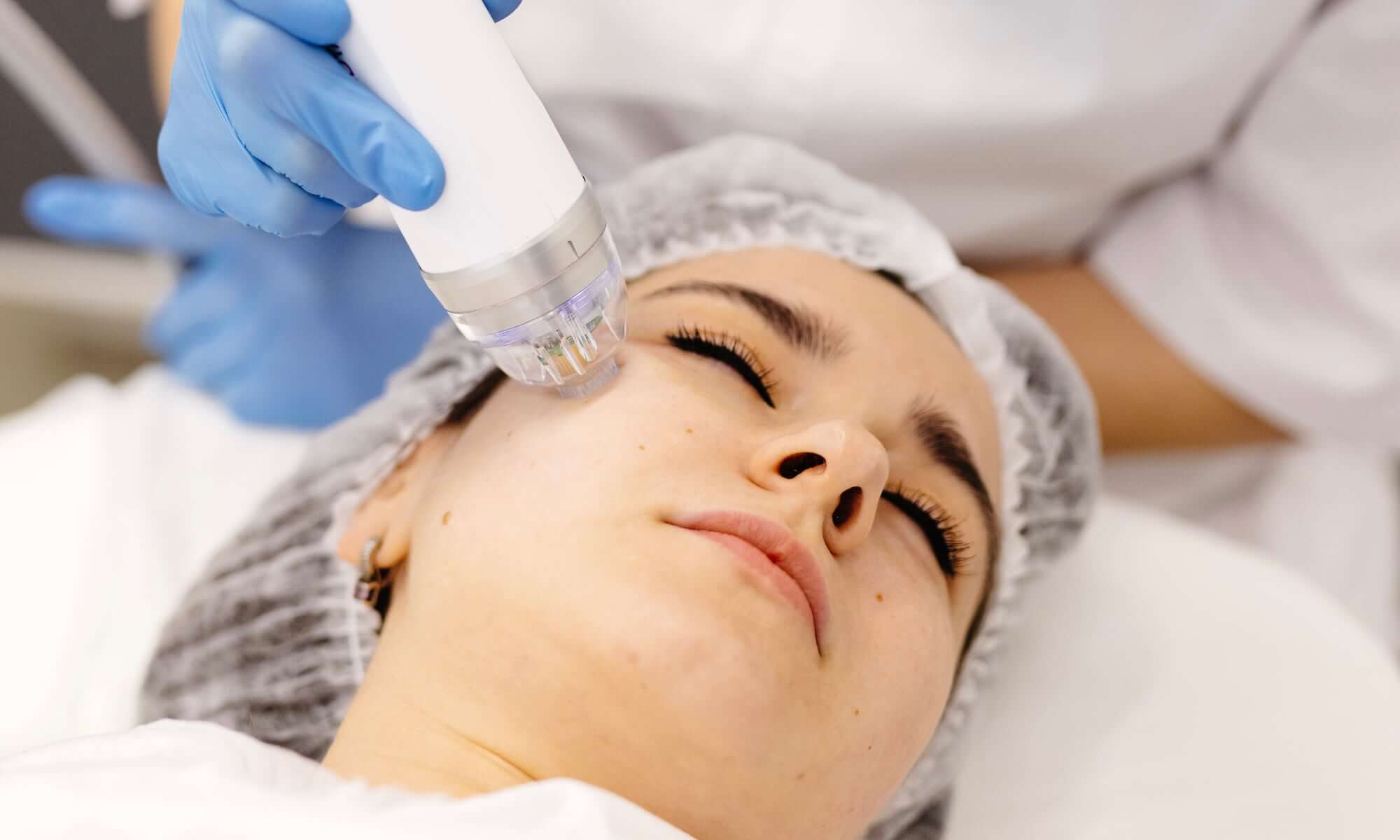 Послуга RF-ліфтингу