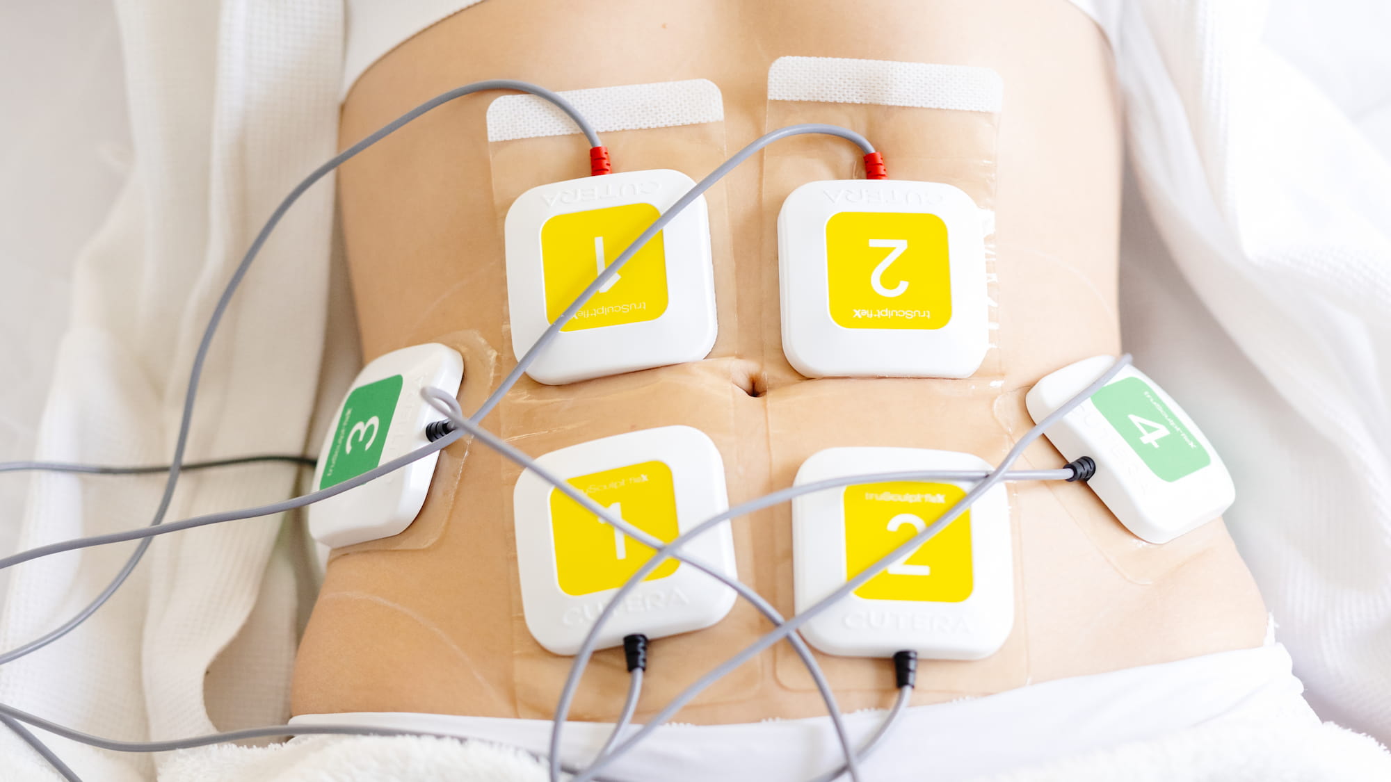 Корекція фігури на апараті TRUSCULPT Flex-_13