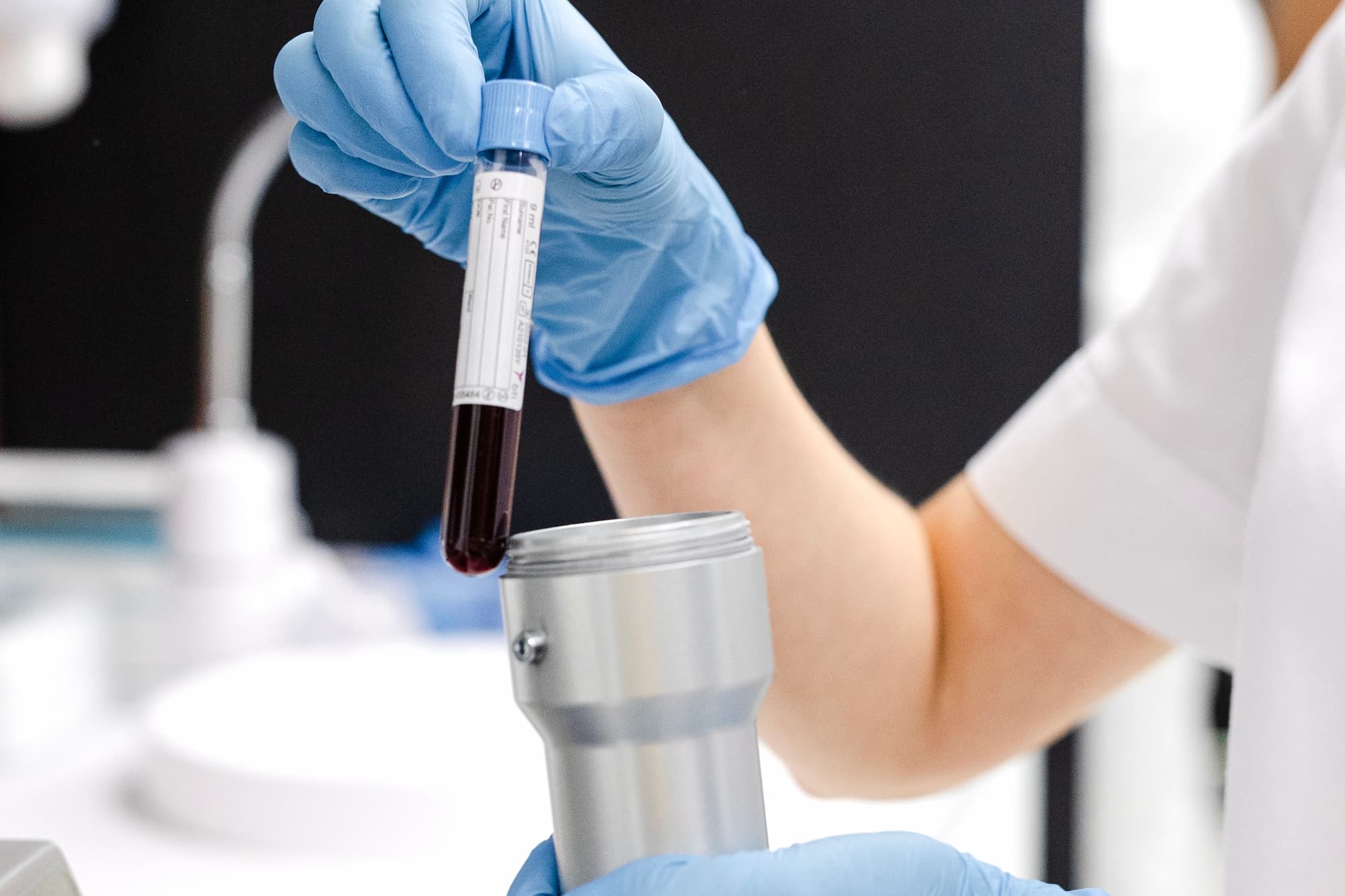 Плазмотерапія Endoret PRGF-_2