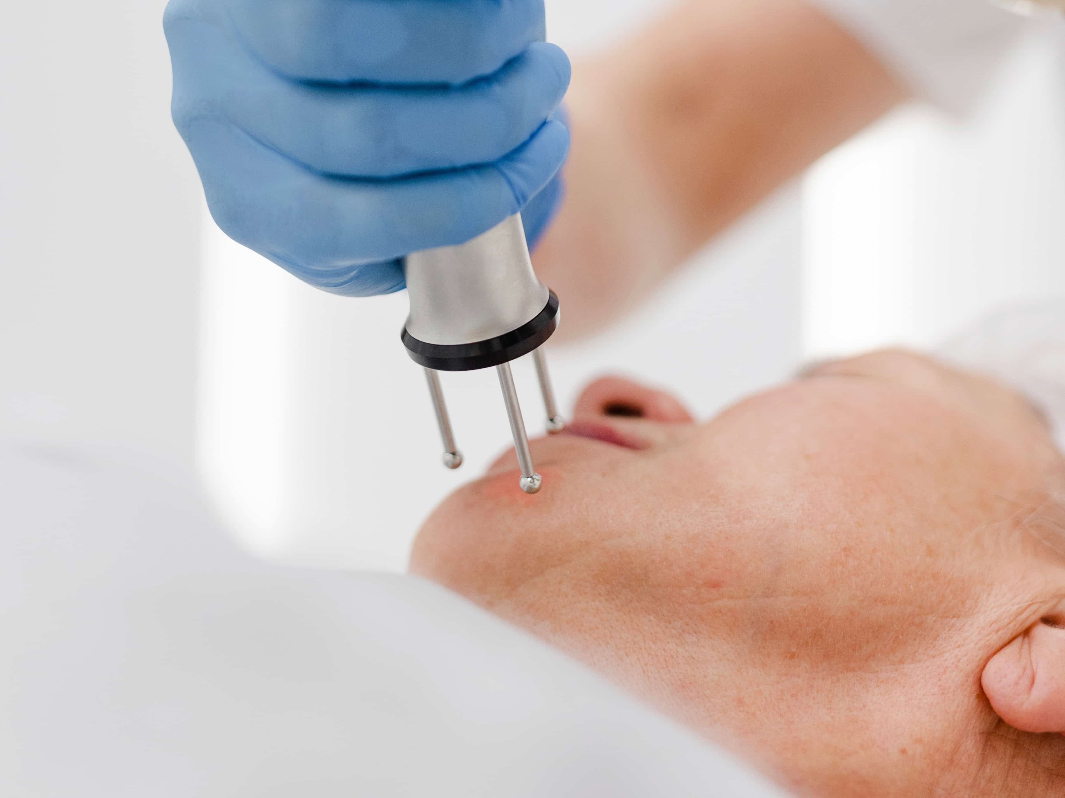 Шліфування шкіри Dermablate New-_8