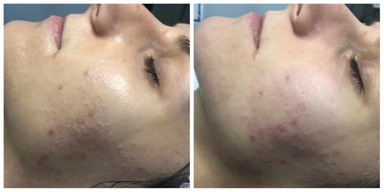 Механічна чистка-_1